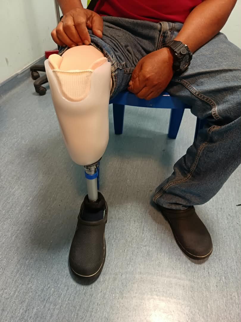 Pengguna memakai kaki palsu bawah lutut Pakej Basic