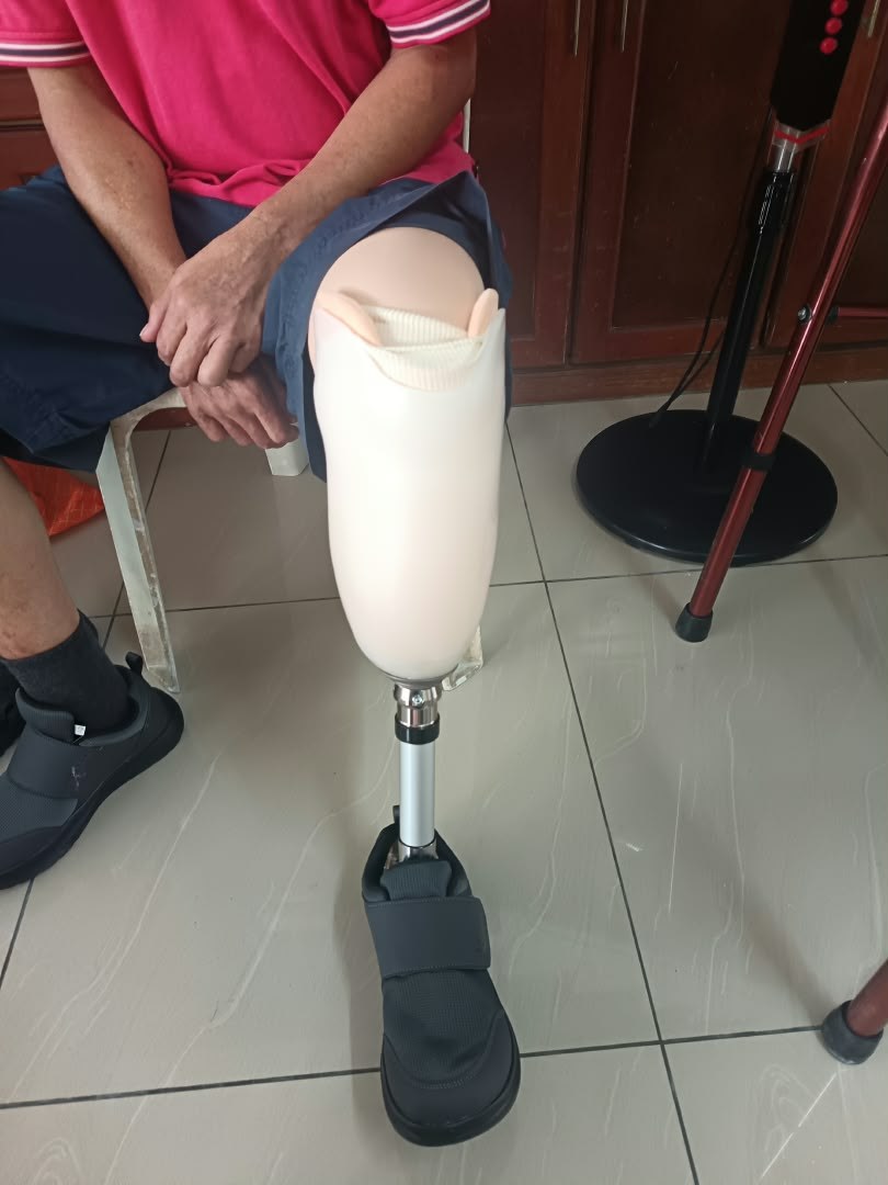 Pengguna menunjukkan kaki palsu bawah lutut Pakej Basic