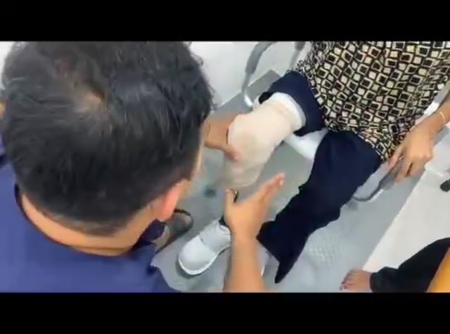 Kerja penyediaan komponen kaki palsu bawah lutut