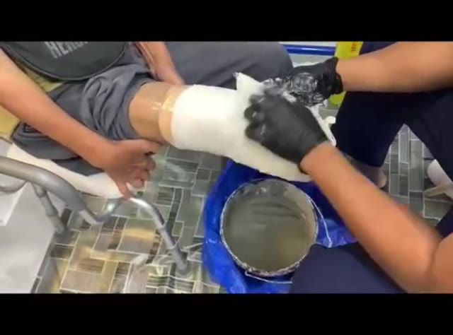 Fitting kaki palsu bawah lutut bersama pengguna