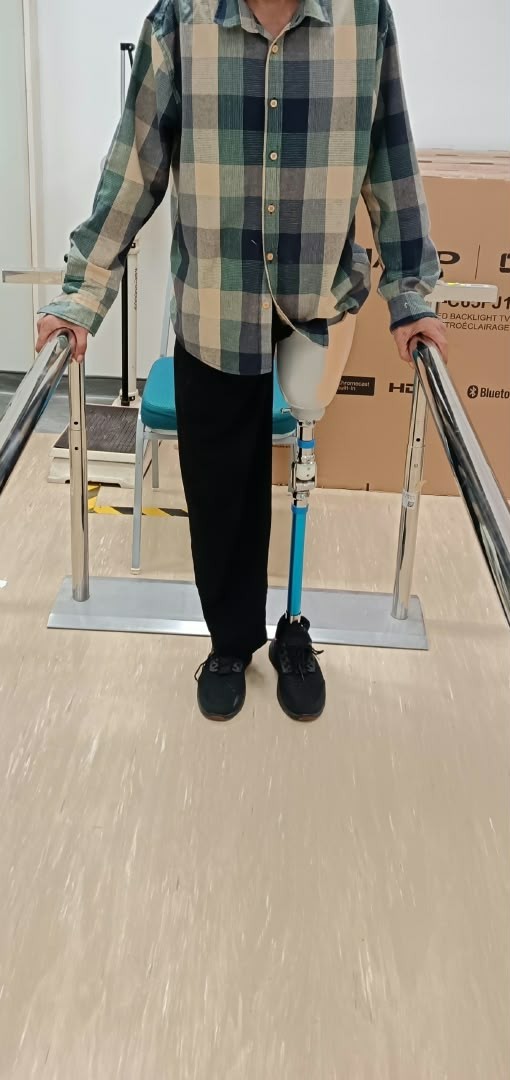 Pengguna mencuba kaki palsu atas lutut di antara palang latihan