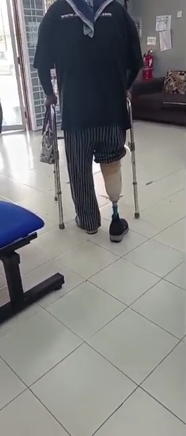 Latihan berjalan menggunakan kaki palsu