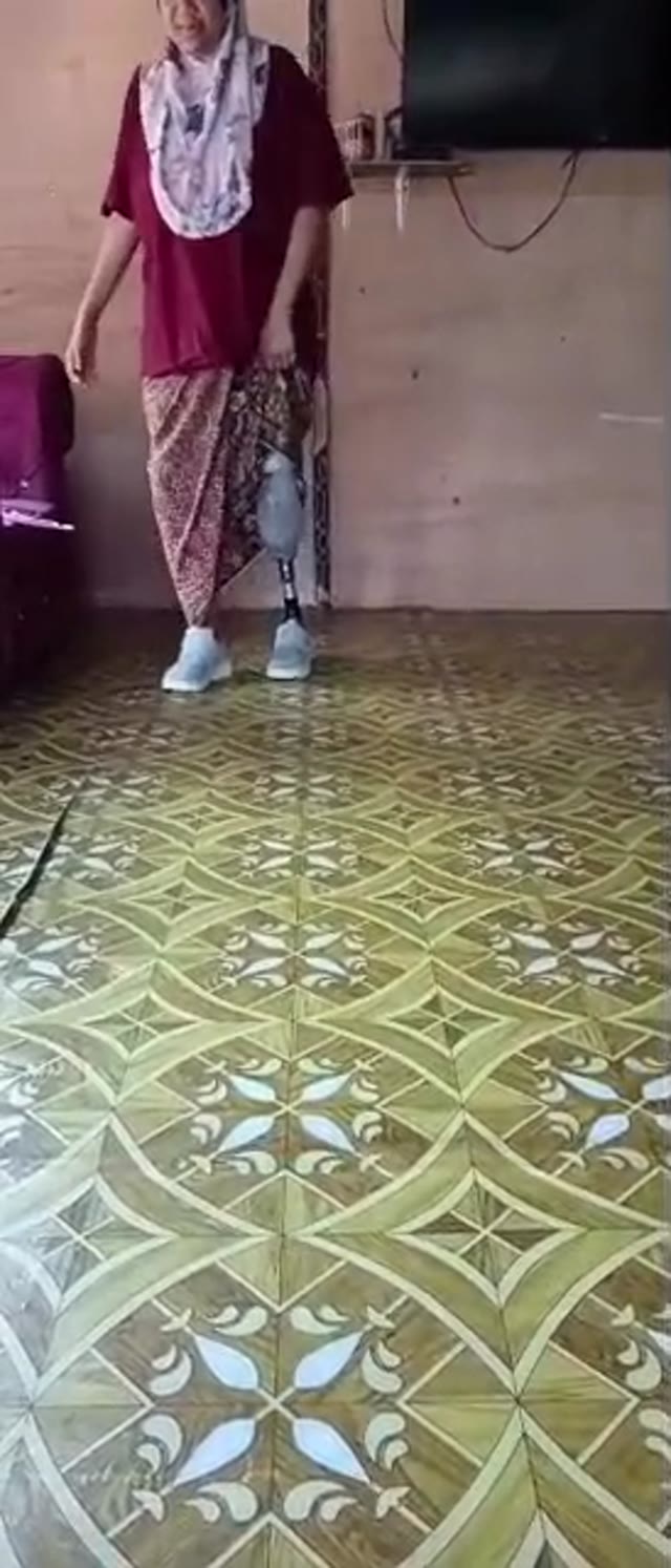 Pengguna bergerak menggunakan kaki palsu