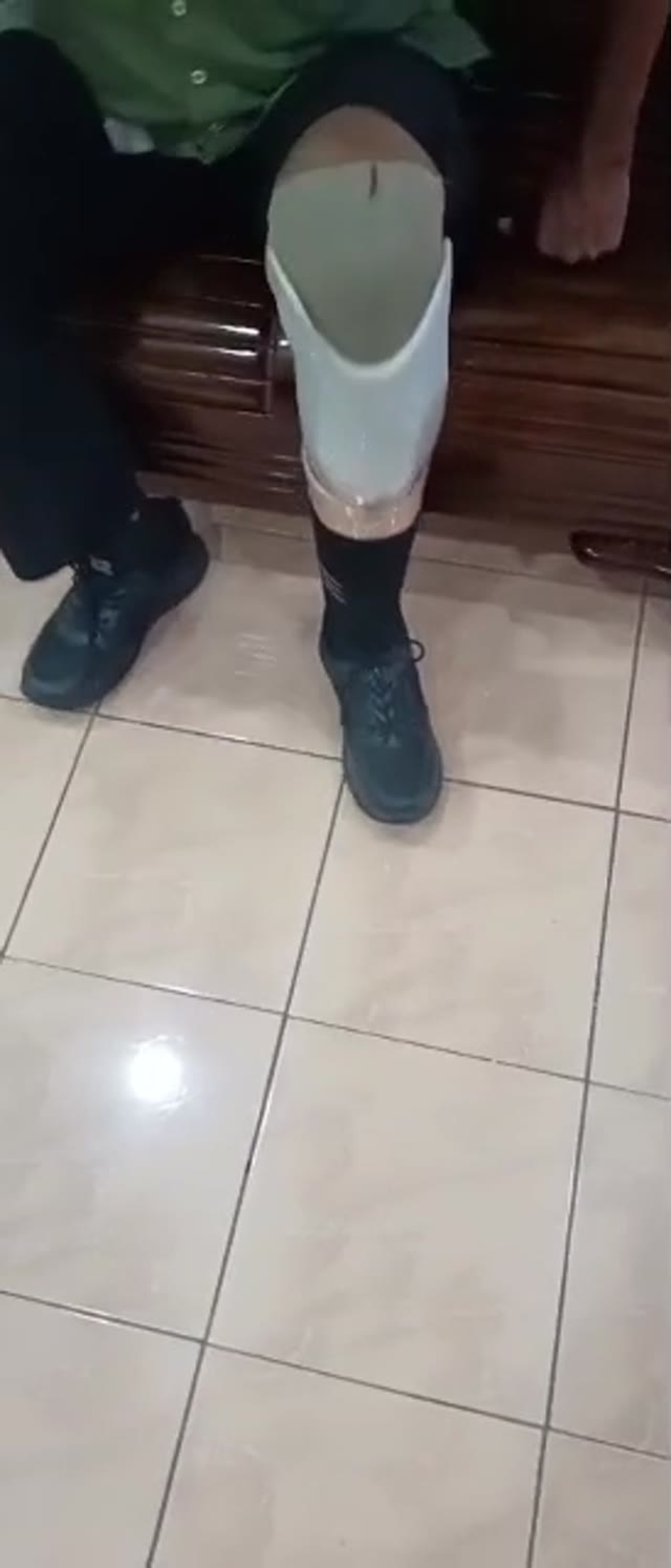 Pelarasan kaki palsu bawah lutut semasa fitting
